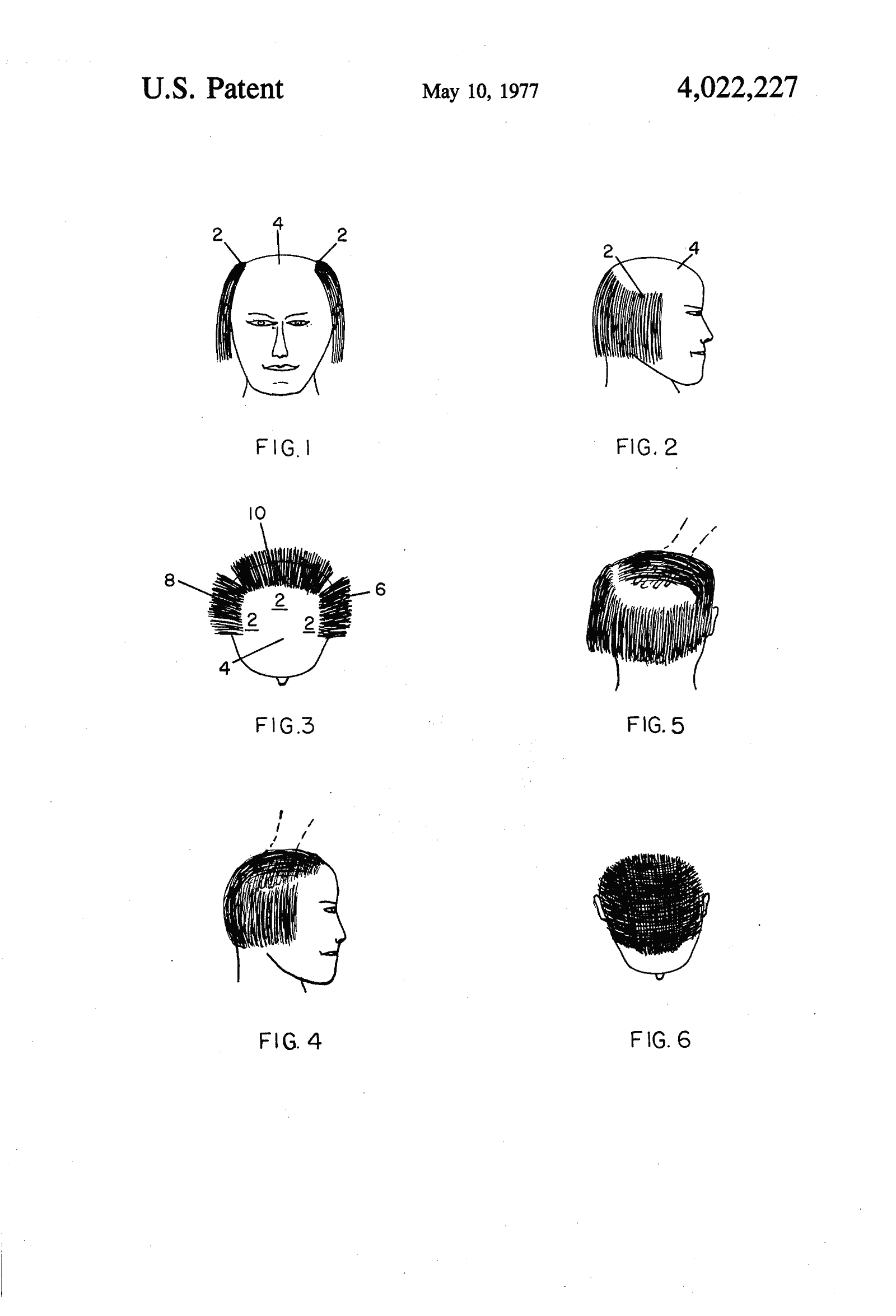 Original patent drawing for "Method of concealing partial baldness", U.S. Patent 4,022,227 (1977)